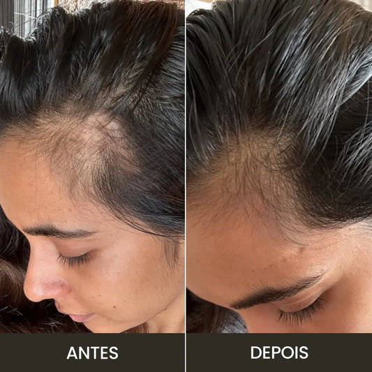 Massageador Elétrico para Couro Cabeludo | Crescimento e Nutrição Natural