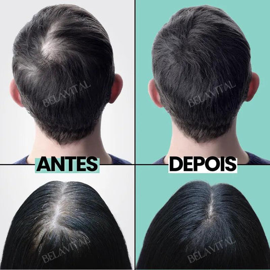 Repair Hair®: 95% Menos Queda 20x Mais Crescimento | Compre 1, Leve 2