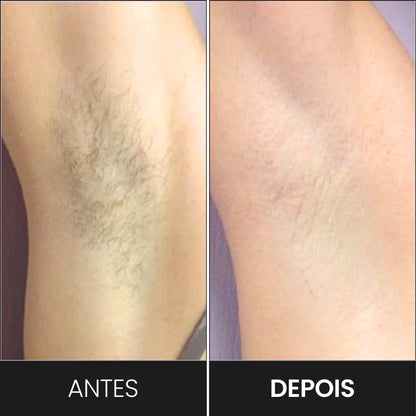 Depiladora IPL BelaVital + 2 Brindes