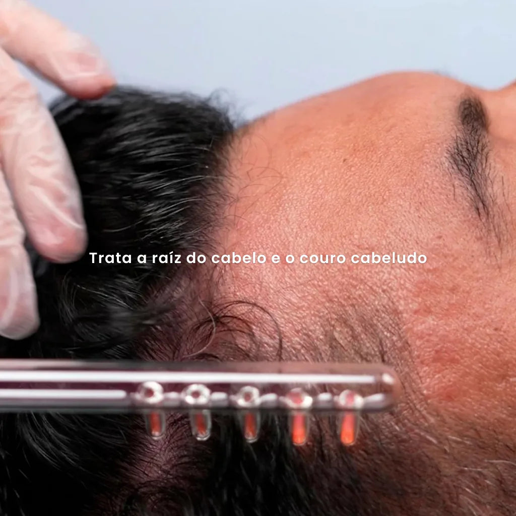 Eletrodo Pente 5 Dentes P/ Alta Frequência | Derma Capilar™