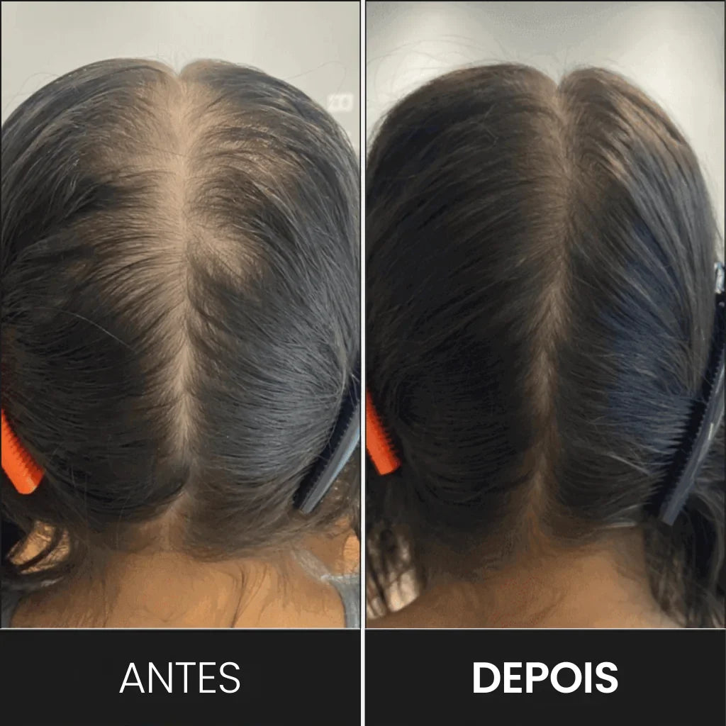 FEG Plus+: Spray de Crescimento Capilar Intensivo
