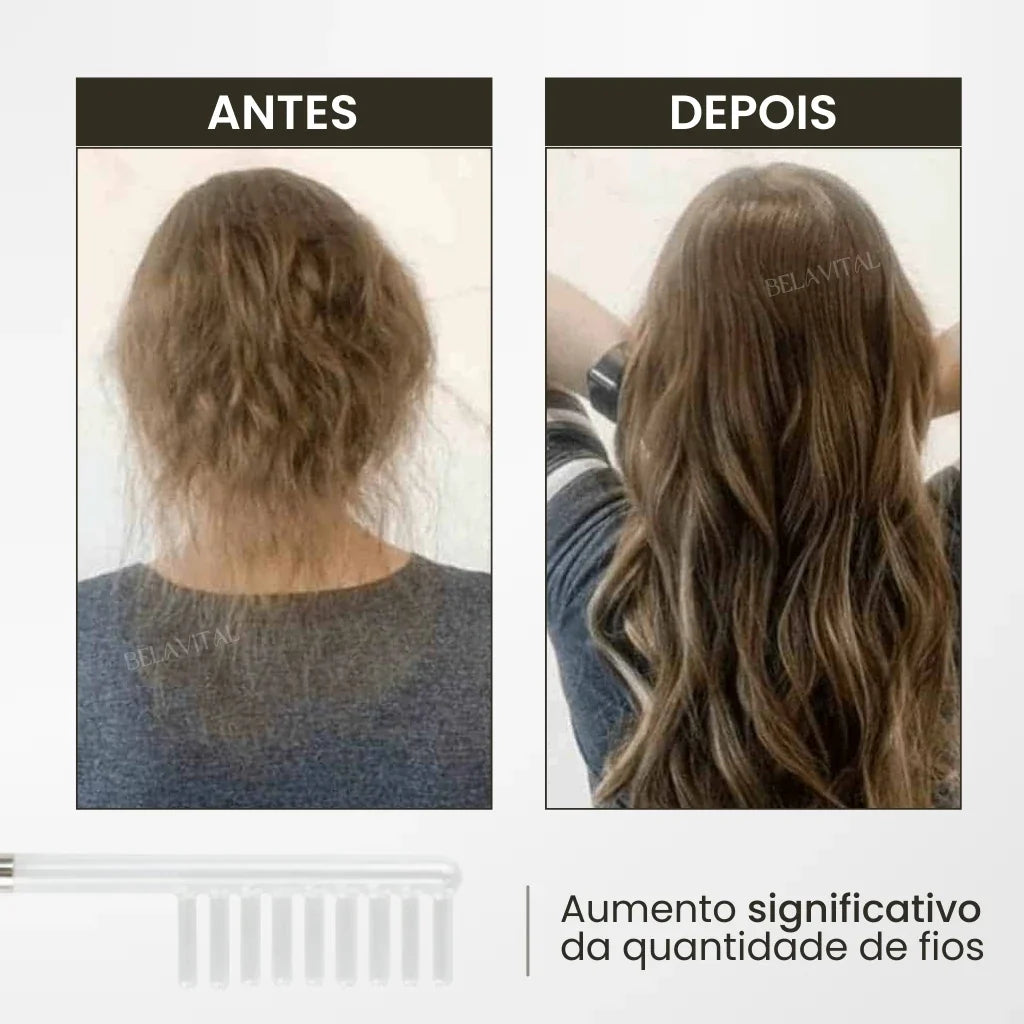 Escova de Alta Frequência: Inovação para Revitalização Capilar
