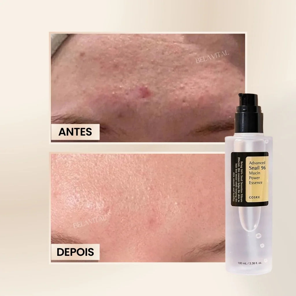 Sérum Coreano Advanced Snail 96: Reparação com Mucina de Caracol