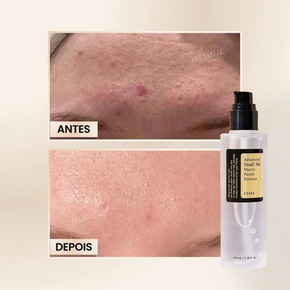 Sérum Coreano Advanced Snail 96: Reparação com Mucina de Caracol