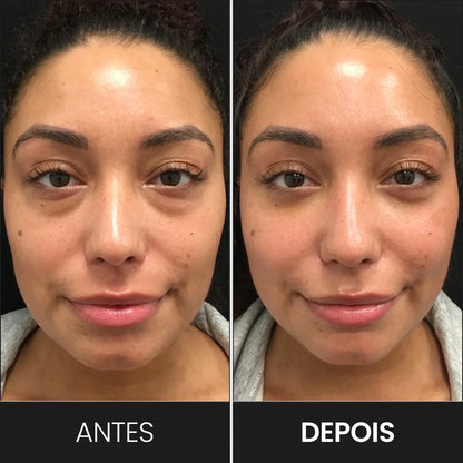 Óculos Terapêuticos Red Light: Adeus Olheiras e Bolsas