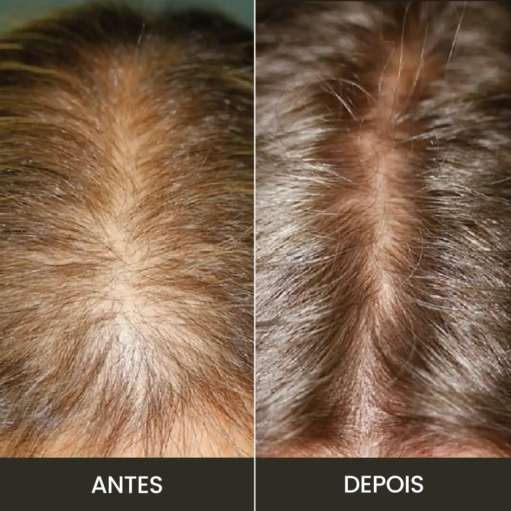 Kit Premium Hair: Fortalece e Cresce - Completo