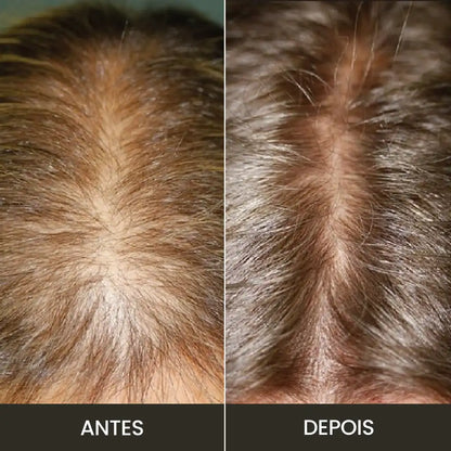 Kit Premium Hair: Fortalece e Cresce - Completo