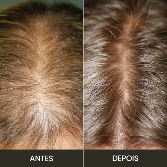 Kit Premium Hair: Fortalece e Cresce - Completo