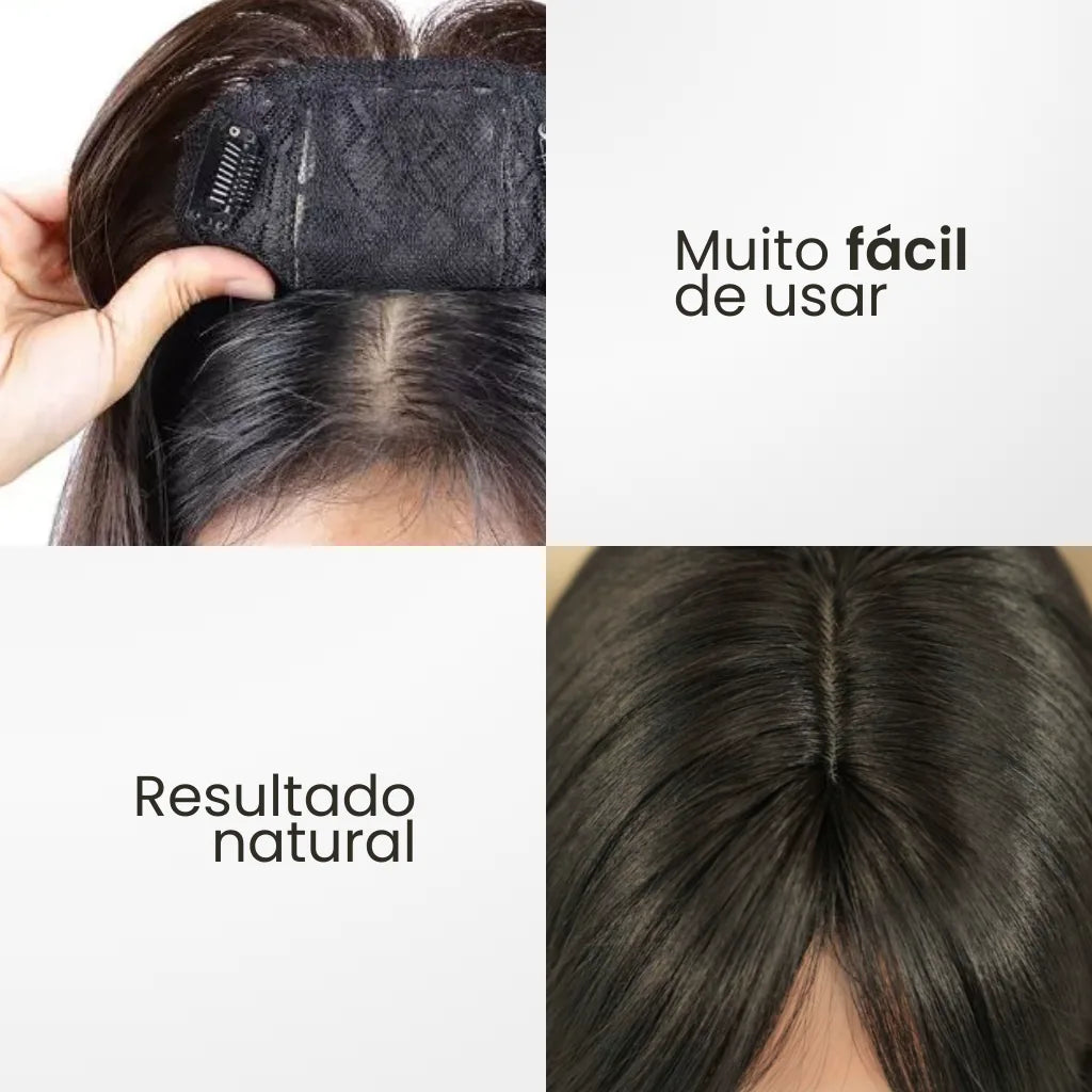 Top Closure - Topo de Cabelo com Franja 45cm | Para Alopecia e Falhas