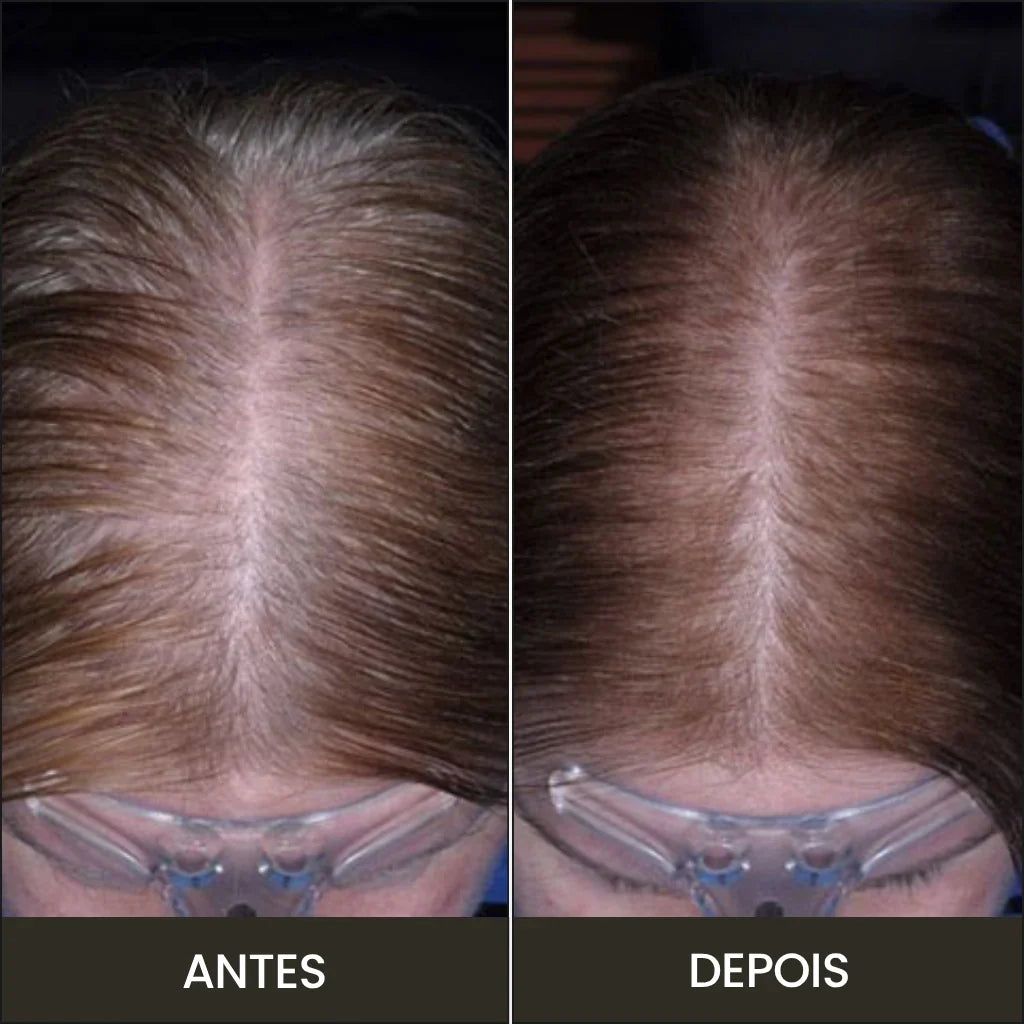 Pente BreoBrush: Terapia de Luz, Massageador e Difusor
